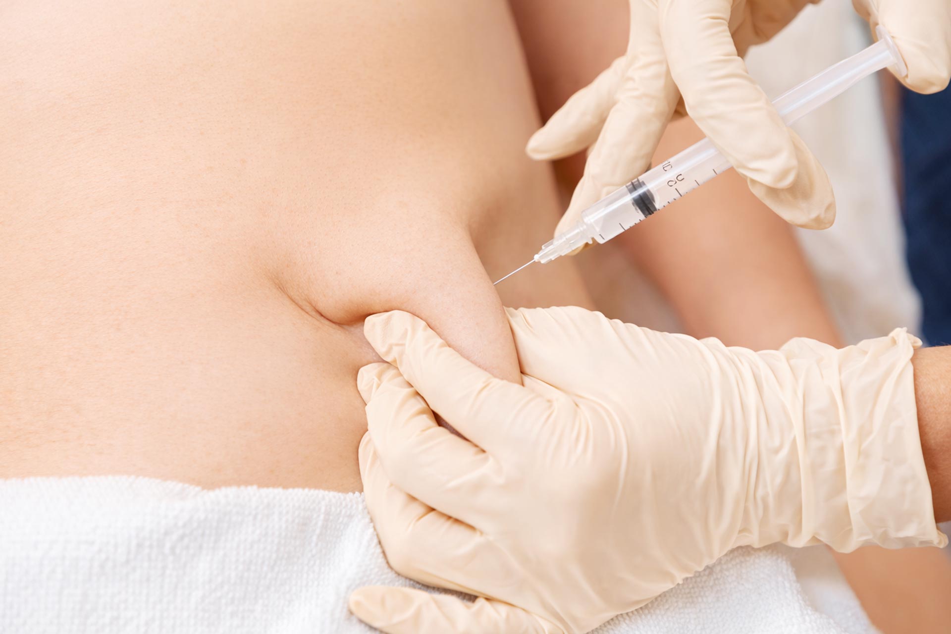 Fettweg-Spritze Praxis