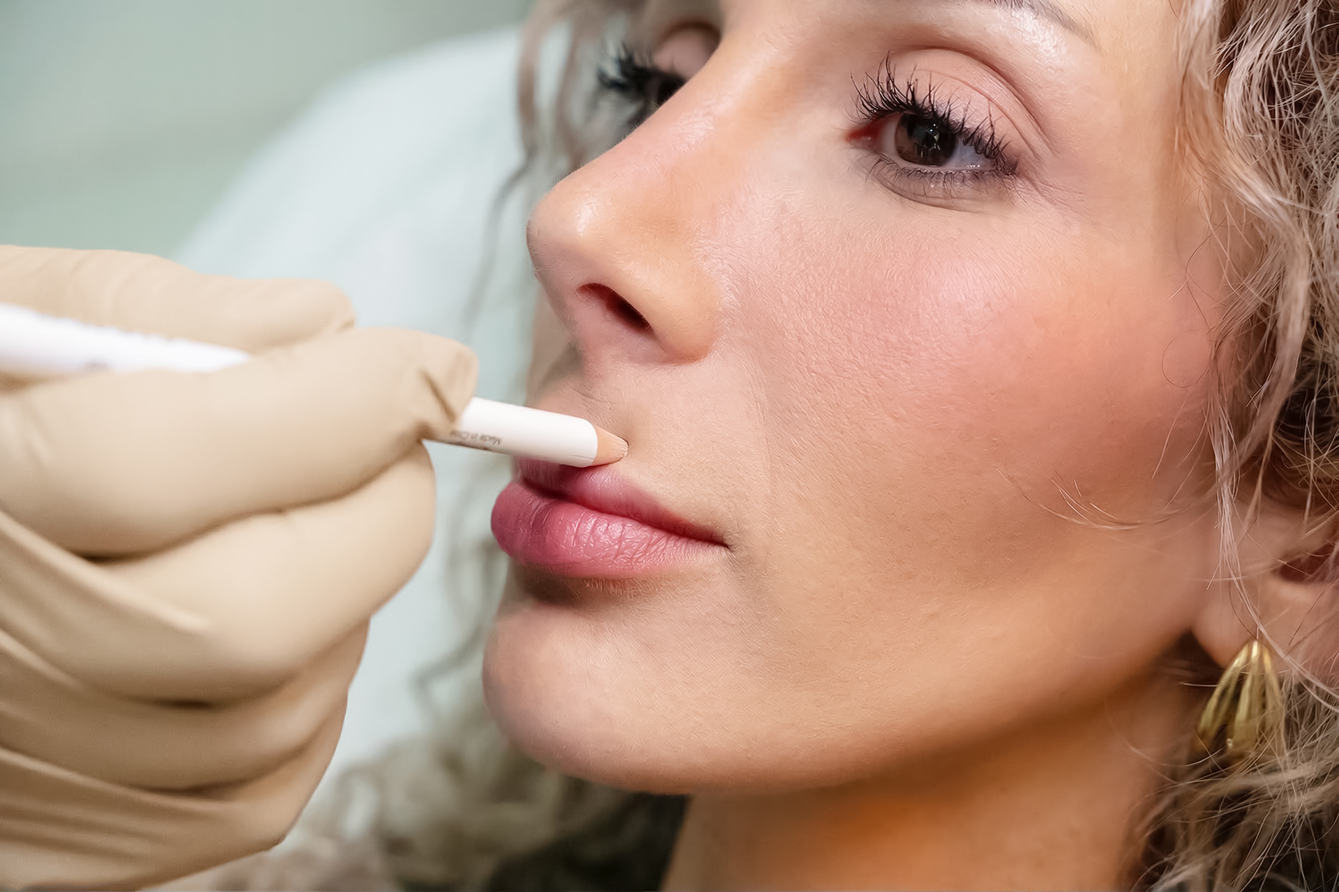 Lippenlifting Vorbereitung