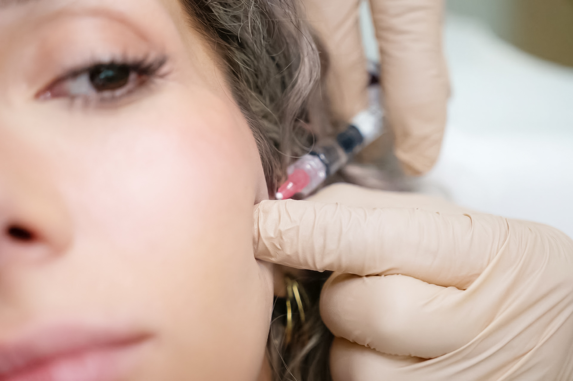 Behandlung der Hängebäckchen